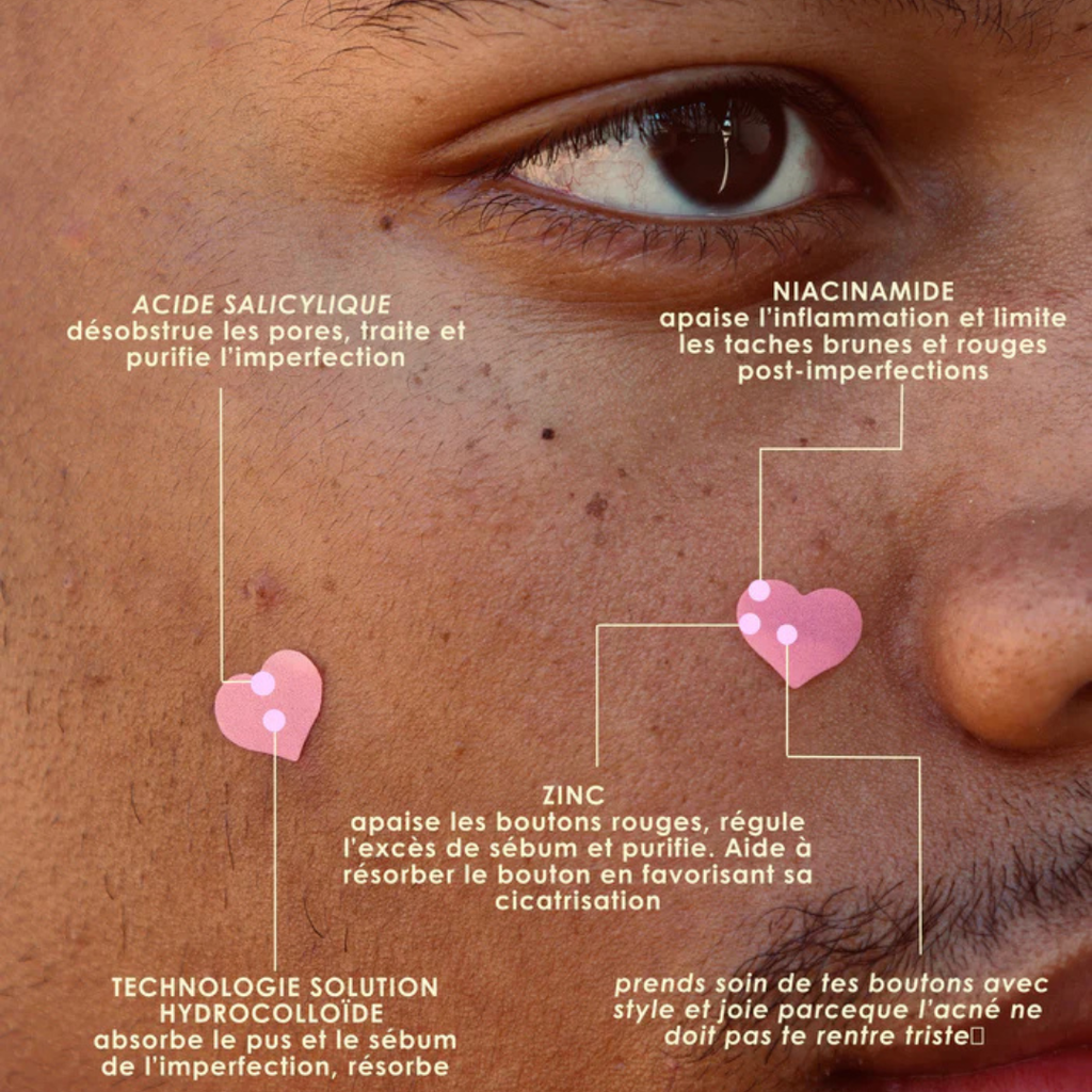 Bye Blemish patchs - 24 patchs coeurs