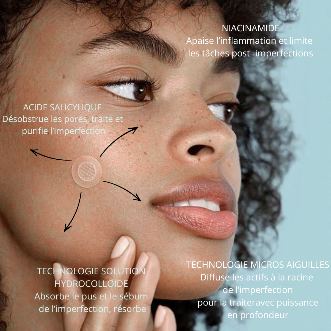 Bye Blemish patchs - 24 patchs micros-aiguilles